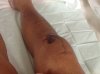 [Bonesmart.org] Anemic after TKR ..exhausted