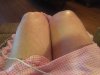 [Bonesmart.org] Diane's KneeQuest,  NewKnee Inn Recovery