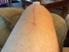 [Bonesmart.org] Papas new knee<