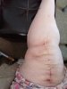 [Bonesmart.org] The girl with the two fake knees