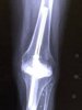[Bonesmart.org] Finally Finishing Up