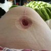 [Bonesmart.org] The girl with the two fake knees