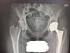[Bonesmart.org] Ouch's Odyssey the Other Side