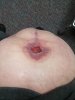[Bonesmart.org] The girl with the two fake knees