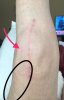 [Bonesmart.org] New Year, New Knee - Jan. 3, 2017<