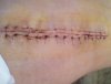 [Bonesmart.org] 4cats1home Knee Recovery