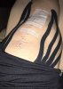 [Bonesmart.org] One year kneeversary