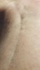 [Bonesmart.org] 2017 August Hot Shots - Are you having knee surgery in August?