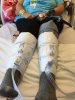 [Bonesmart.org] Third times the charm- hopefully