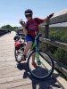 [Bonesmart.org] No Kneecap and a TKR Experience