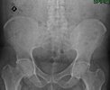 [Bonesmart.org] Feeling good