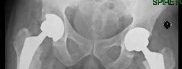 [Bonesmart.org] Feeling good