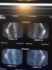[Bonesmart.org] Revision again