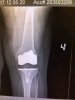 [Bonesmart.org] Third times the charm- hopefully