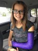 [Bonesmart.org] Jennszoo Staged TKR, working on running again