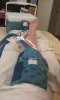 [Bonesmart.org] Member, ODIC --TKR 24 July 17