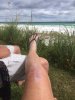 [Bonesmart.org] New Year, New Knee - Jan. 3, 2017<