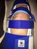 [Bonesmart.org] UPDATE - MUA determined today...ugh!