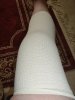 [Bonesmart.org] 6 months still stiff