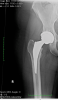 [Bonesmart.org] Looks like maybe a revision will be needed...