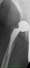 [Bonesmart.org] Looks like maybe a revision will be needed...