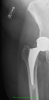 [Bonesmart.org] Looks like maybe a revision will be needed...