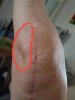[Bonesmart.org] New left knee