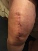 [Bonesmart.org] Rehab Starts now !