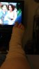 [Bonesmart.org] The girl with the two fake knees