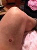 [Bonesmart.org] REM's Recovery Thread<