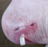 [Bonesmart.org] The girl with the two fake knees