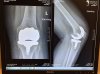 [Bonesmart.org] It's The HoneyB's Knees