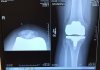 [Bonesmart.org] It's The HoneyB's Knees