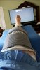 [Bonesmart.org] Lovetocookandsew’s long road to recovery