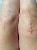 [Bonesmart.org] It's The HoneyB's Knees