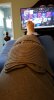 [Bonesmart.org] Lovetocookandsew’s long road to recovery