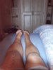 [Bonesmart.org] Pain 2 years after TKR