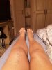 [Bonesmart.org] Pain 2 years after TKR