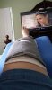 [Bonesmart.org] Lovetocookandsew’s long road to recovery
