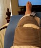 [Bonesmart.org] Lovetocookandsew’s long road to recovery