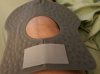 [Bonesmart.org] Lovetocookandsew’s long road to recovery