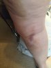 [Bonesmart.org] Katchmo's Knees: Round Two!