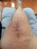 [Bonesmart.org] DLR recovery #2
