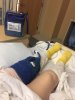 [Bonesmart.org] Joy's Recovery thread<