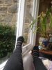 [Bonesmart.org] 79newknees Recovery Thread