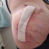 [Bonesmart.org] JoeKnows Recovery
