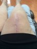 [Bonesmart.org] DLR recovery #2