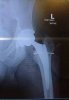 [Bonesmart.org] JoeKnows Recovery
