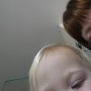 [Bonesmart.org] Bickypeg's new hip