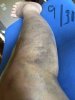 [Bonesmart.org] My 2nd Journey Begins